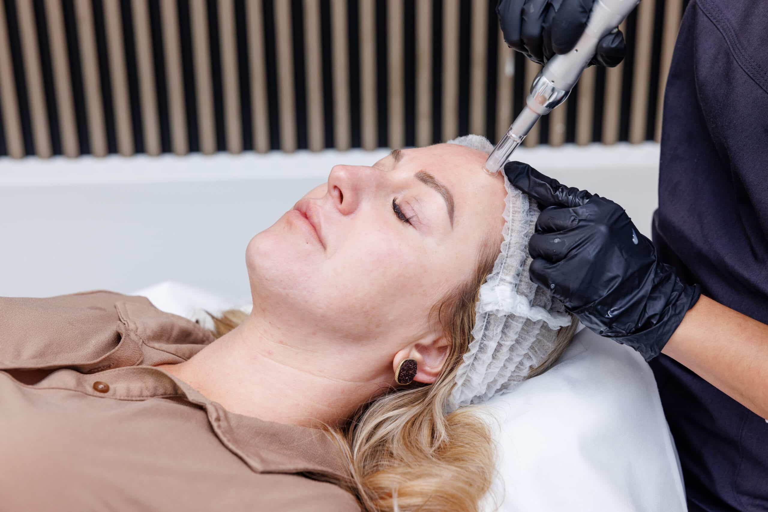 Microneedling Promo